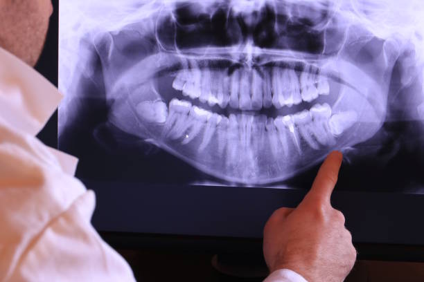 Best Emergency Dentist for Knocked-Out Tooth in Colonia, NJ