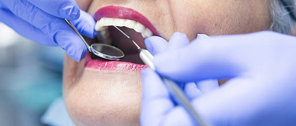 Best Emergency Dental Extractions in Colonia, NJ
